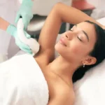 Laser Hair Removal